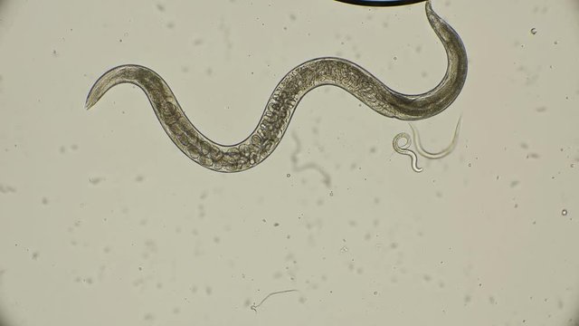 The female roundworm Turbatrix aceti gives birth to a formed nematode