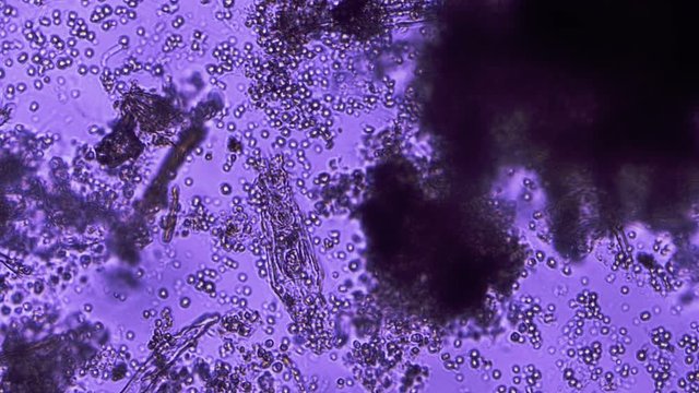 Rotifer Protozoan Feeding Phase Contrast Microscope 200x Violet Filter
