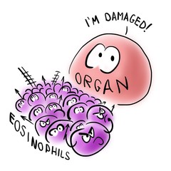 Eosinophils and organ damage