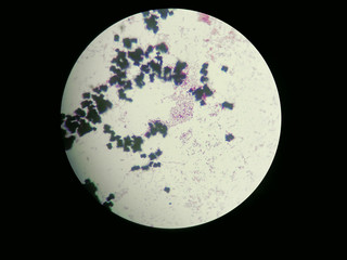 Image of Escherichia coli obtained through a light microscope