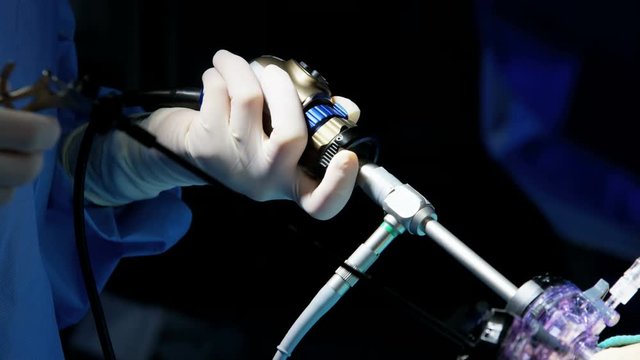 European Caucasian surgical team in scrubs performing laparoscopic surgery on the patient in operating theatre using video camera playback technology 