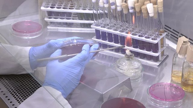 Sanitary and microbiological study of animal meat. Lab worker analyzing meat sample magnifying glass. Laboratory studies of meat and meat products. Checking meat for compliance with sanitary requireme