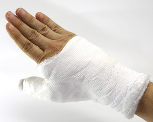 Hand cast fractured after an accident