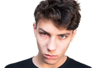 Teenage boy with red eyes on a white background. The guy is sad because the eye is very sore...