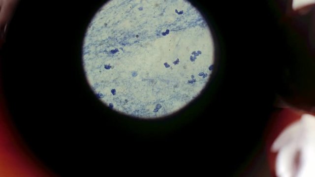 Human blood and dna laboratory, genetic laboratory, stem cells, medicine of the future, doctors take a blood sample, look through a microscope, human genetic code