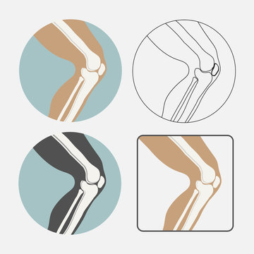 Human Knee Joint Icon Set, Logo For Orthopedic Clinic, Flat Styl