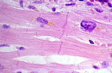 Cardiac myocytes. Lipofuscin