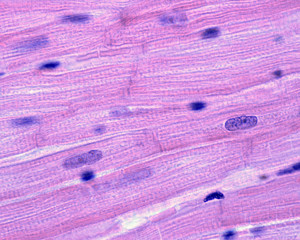 Myocardium. Striated muscle fibers
