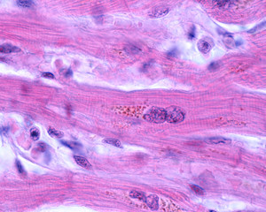 Cardiac myocytes. Lipofuscin