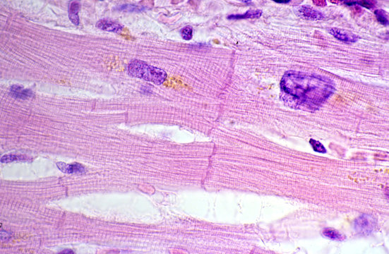 Cardiac Myocytes. Lipofuscin