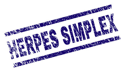 HERPES SIMPLEX seal print with distress style. Blue vector rubber print of HERPES SIMPLEX text with grunge texture. Text title is placed between parallel lines.