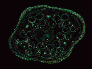 brassica flower - cross section cut under the microscope – microscopic view of plant cells for...