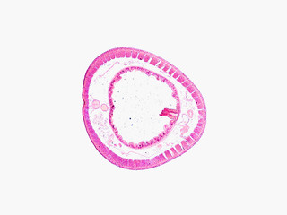 cross section cut under the microscope – microscopic view of earthworm for education