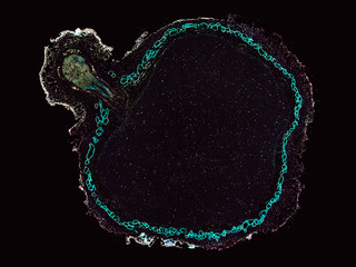 rhizobium soybean root with unattached nodule - cross section cut under the microscope – microscopic view of plant cells for botanic education