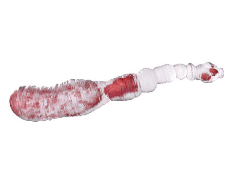 3d rendered medically accurate illustration of an echinococcus granulosus