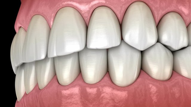 Healthy human teeth with normal occlusion, side view. Medically accurate tooth 3D animation