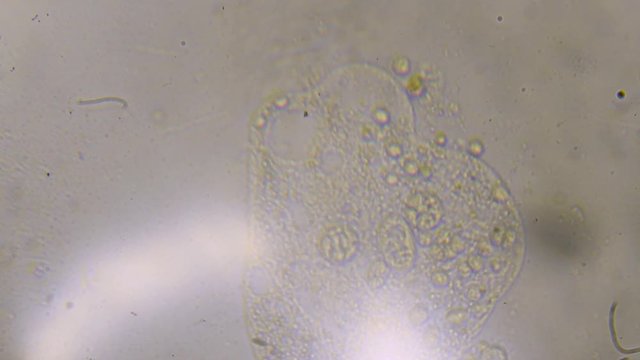 A dying ciliate microscopic animal has it's cell wall broken, the contents scatter in the water