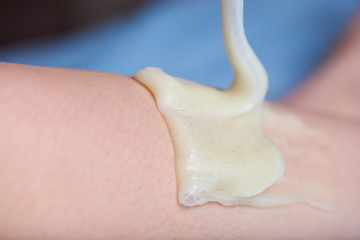 Sugar wax with hair on a leg in a process of sugaring depilation