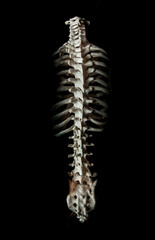Spine human bone close up isolated on black background