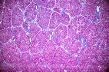 Tissue of Liver under the microscope for education in Laboratory physiology.