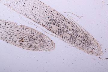Mitosis cell in the Root tip of Onion under a microscope.