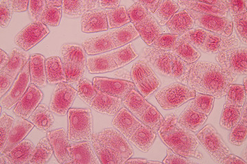 Mitosis cell in the Root tip of Onion under a microscope.