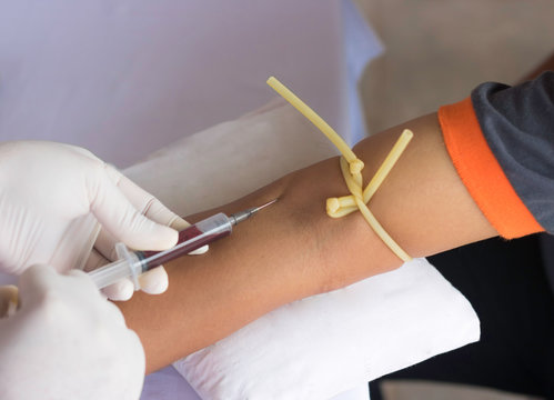 Blood donation to people with blood deficiency. Blood test to check. Health check to bring blood to analyze for disease in the body. - Powered by Adobe