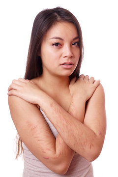 crying young asian woman with self-inflicted cuts on her arms