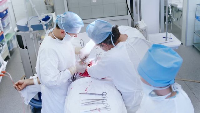 Top view group of professional surgeons performing operation on abdominal cavity in operating room