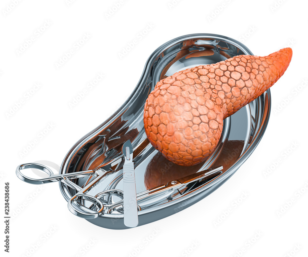Poster pancreatic operation or transplantation concept. 3d rendering