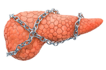 Pancreatic disease concept. Human pancreas with chain. 3D rendering - obrazy, fototapety, plakaty