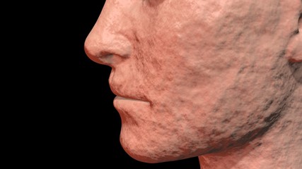 Naklejka premium Skin Problems : old, weathered, sun damaged wrinkled skin . 3d render