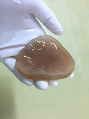 Bacterial cellulose boiled by NaOH  