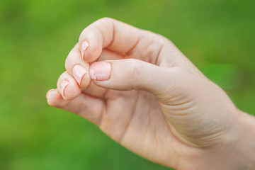 Broken nail on a woman's hand with a manicure on a green background