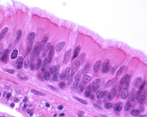 Ciliated pseudostratified columnar epithelium