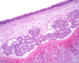 Human epiglottis. Laringeal surface