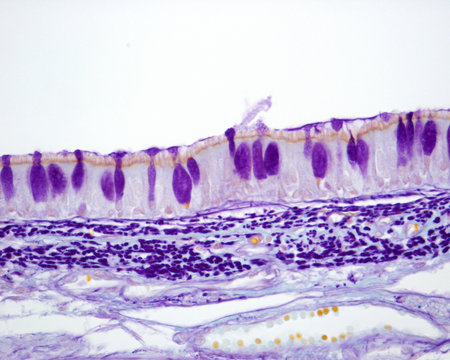 Tracheal mucosa. Gabe technique