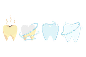 The concept of dental care. The stage of cleaning and whitening teeth. Oral Care, before and after brushing teeth. Vector illustration.