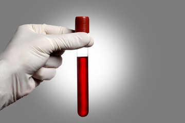 hand with glove holding a blood test tube on grey  background  and copy space for your text
