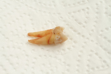 Remove tooth on white paper napkin