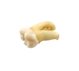 Remove eighth lower tooth with a piece of bone tissue on white background. Wisdom tooth