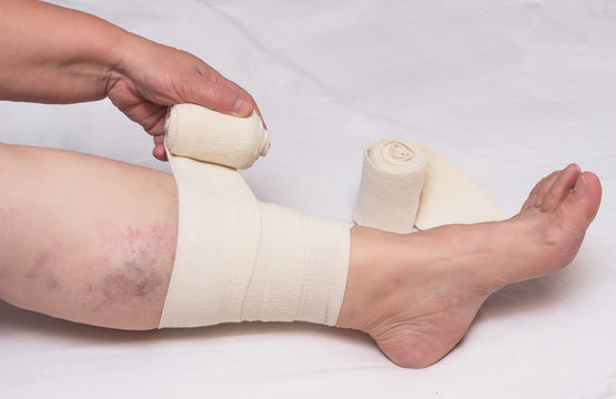 Woman bandages leg with elastic bandage against varicose veins on legs and thrombosis, close-up, white background, phlebeurysm, medical, trauma