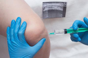 A doctor injects a medical injection of chondroprotector and hyaluronic acid into the knee of a...