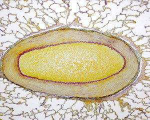 Lung. Pulmonary artery