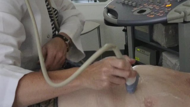 Doctor in white robe performs ultrasound examination of the female breast in the clinic. Scanning of a breast of the adult woman