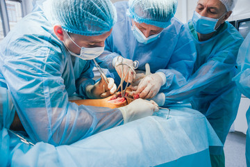 Process of trauma surgery operation. Group of surgeons in operating room with surgery equipment.