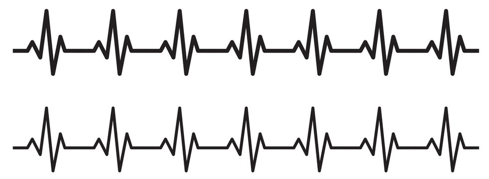 TRAC&Eacute; GRAPHIQUE SIMPLIFI&Eacute; D'UN CARDIOGRAMME