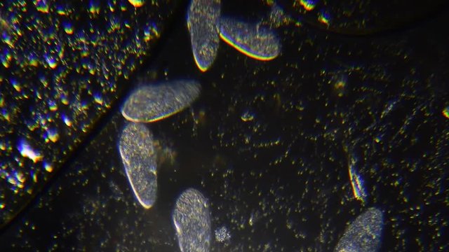 Dark Field Microscopy footage showing ciliate paramecium from pond water