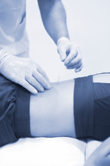 Fototapeta premium Dry needling EPI needle