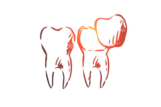 Veneer, dental, care, dentistry, whitening concept. Hand drawn isolated vector.